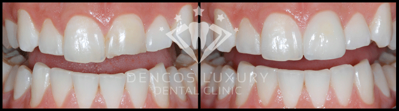 Hiệu quả tùy cơ địa mỗi người mat-dan-su-3