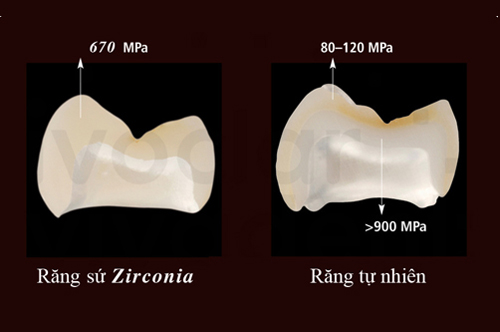 Răng sứ Zirconia có các đặc tính tương tự như răng tự nhiên phuc-hinh-rang-su2